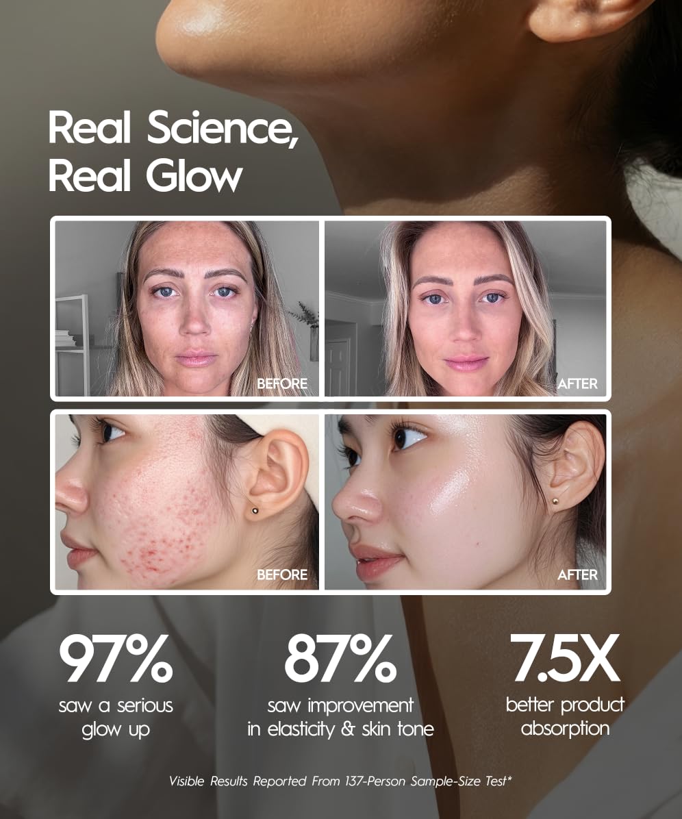 Appareil de massage facial REVO Genie destiné à le visage et le cou, lifting du visage par LED doté de chaleur et vibration, drainage lymphatique, décongestionnant, luminothérapie rouge, bleue et verte destiné à raffermir la peau et favoriser...